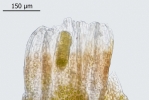 Cephaloziella baumgartneri