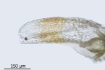 Cephaloziella baumgartneri