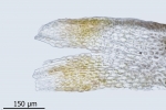 Cephaloziella baumgartneri