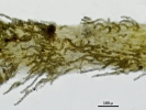 Thuidium pristocalyx var. samoanum