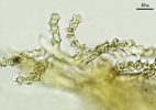 Thuidium pristocalyx var. samoanum