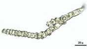 Thuidium cymbifolium
