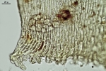 Camptochaete porotrichoides