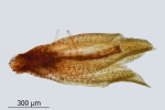 Encalypta pilifera
