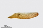 Encalypta pilifera