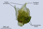Rhynchostegium rotundifolium