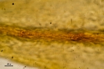 Pterobryella rigida