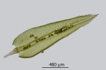 Aulacomnium androgynum