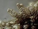 Lepidolejeunea novae-caledoniae