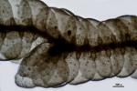Lepidolejeunea novae-caledoniae