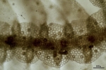 Lepidolejeunea novae-caledoniae
