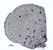 Lepidolejeunea novae-caledoniae