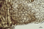 Lepidolejeunea novae-caledoniae