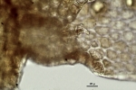 Lepidolejeunea novae-caledoniae