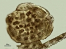 Lepidolejeunea novae-caledoniae