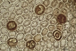 Lepidolejeunea novae-caledoniae
