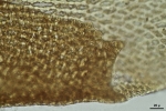 Thysananthus spathulistipus