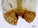 Dicranoloma calycinum