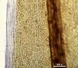 Dicranoloma calycinum