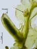 Pallavicinia lyellii