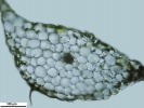 Pallavicinia lyellii