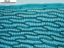 Sphagnum torreyanum