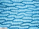 Sphagnum torreyanum