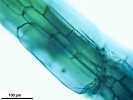 Sphagnum torreyanum