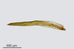 Gymnostomum aeruginosum