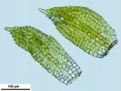 Syntrichia laevipila