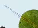 Syntrichia laevipila