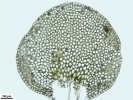 Solenostoma confertissimum