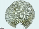 Solenostoma confertissimum