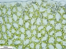Solenostoma confertissimum
