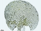Solenostoma confertissimum