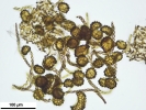 Fossombronia foveolata