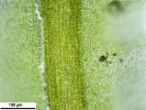 Tortella tortuosa var. fragilifolia
