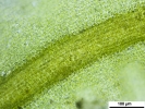 Tortella tortuosa var. fragilifolia