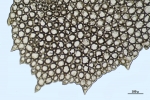 Schistochila caledonica