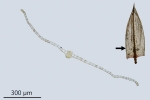 Ptychostomum turbinatum