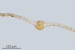 Ptychostomum turbinatum