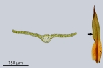 Trichostomum herzogii