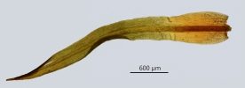 Trichostomum herzogii