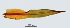 Trichostomum herzogii