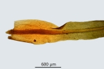 Trichostomum herzogii