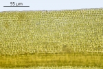 Trichostomum herzogii