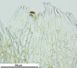 Cephaloziella hampeana