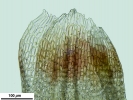Cephaloziella hampeana