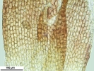 Cephaloziella hampeana