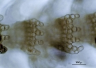 Neolepidozia heterotexta